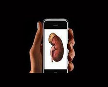 İphone alabilmek için böbreklerini sattı