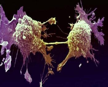 Vücudun Kanserli Hücreleri “Yemesini” Sağlayan İlaç Üretildi