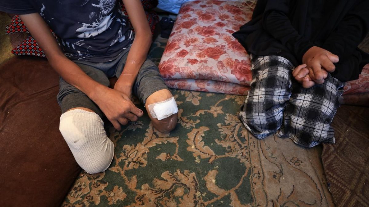 BM Komiseri: "7 Ekim'den bu yana Gazze'de 4 bin çocuk ampute edildi"