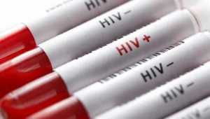 Sağlık Bakanlığı: Sosyal medyadaki HIV paylaşımları gerçeği yansıtmıyor